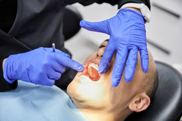 Best Emergency Root Canal Treatment in Houghton, NY