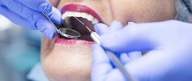 Best Emergency Tooth Extraction in Houghton, NY