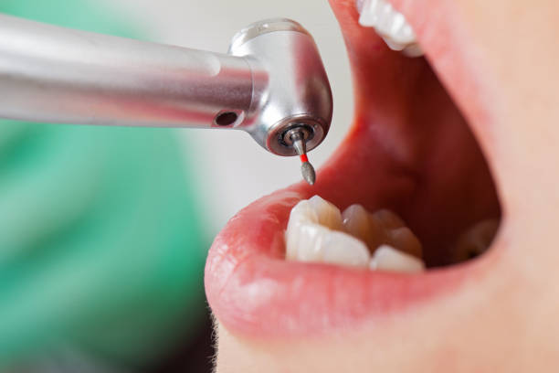 Best Emergency Treatment for Toothache in Houghton, NY